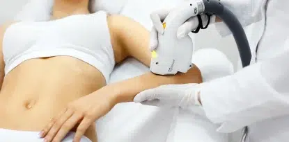 Regl iken lazer yapılır mı?